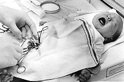Circumcision.gif (46 KB)
