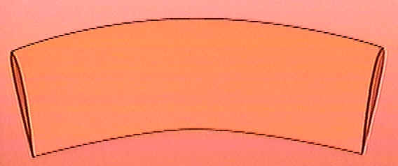 Foreskin Folded.jpg (6 KB)