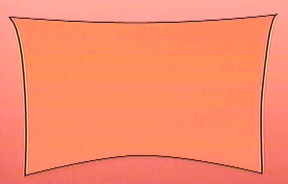 Foreskin Open.jpg (8 KB)