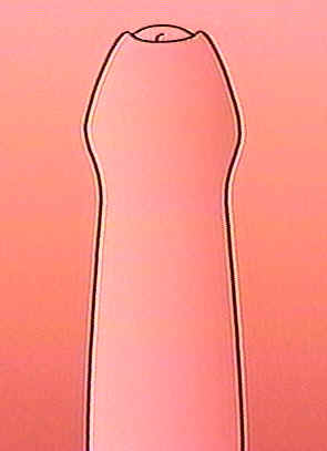 Intact Penis.jpg (6 KB
