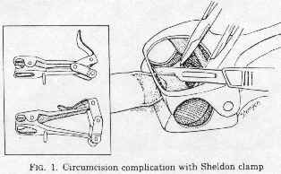 Sheldon Clamp.jpg (9 KB)